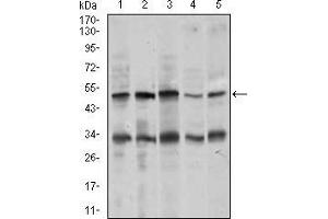 Western blot analysis using CHGA mouse mAb against MOLT4 (1), SK-N-SH (2), HepG2 (3), PC-12 (4), and C6 (5) cell lysate.