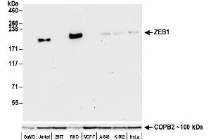 Western Blotting (WB) image for anti-Zinc Finger E-Box Binding Homeobox 1 (ZEB1) (C-Term) antibody (ABIN7795625) (Recombinant ZEB1 anticorps  (C-Term))