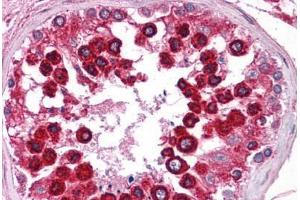 Human Testis: Formalin-Fixed, Paraffin-Embedded (FFPE) (Calnexin anticorps  (AA 109-274))