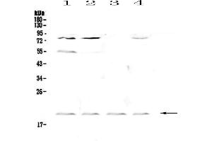 Western blot analysis of CD59 using anti-CD59 antibody . (CD59a anticorps  (AA 24-96))