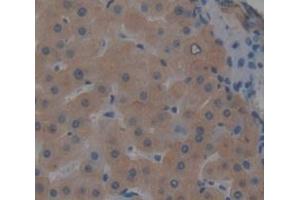 IHC-P analysis of Human Tissue, with DAB staining. (CCL22 anticorps  (AA 25-93))