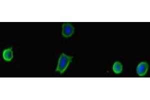 Immunofluorescent analysis of MCF-7 cells using ABIN7173921 at dilution of 1:100 and Alexa Fluor 488-congugated AffiniPure Goat Anti-Rabbit IgG(H+L) (TP53INP2 anticorps  (AA 100-220))