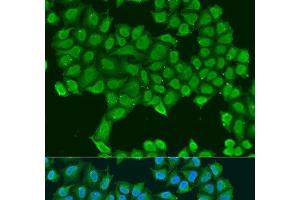 Immunofluorescence analysis of U2OS cells using ATP5O Polyclonal Antibody at dilution of 1:100.