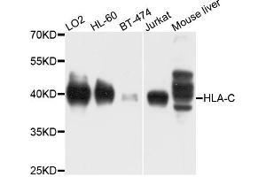 Western blot analysis of extracts of various cell lines, using HLA-C antibody (ABIN4903930) at 1:1000 dilution. (HLA-C anticorps)
