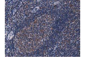 Image no. 6 for anti-Acetyl-CoA Acetyltransferase 2 (ACAT2) antibody (ABIN1496396)