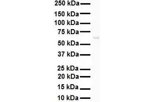WB Suggested Anti-SNRP70 antibody Titration: 1 ug/mL Sample Type: HEK293 (SNRNP70 anticorps  (N-Term))