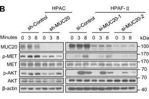 MUC20 knockdown inhibits HGF/MET signalling in PDAC cells.