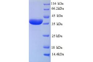 SDS-PAGE (SDS) image for Haptoglobin (HP) (AA 19-346), (partial) protein (His tag) (ABIN5713068)