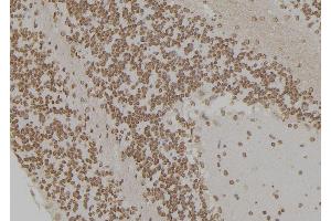 ABIN6276925 at 1/100 staining Rat brain tissue by IHC-P.
