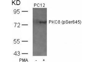 Image no. 2 for anti-Protein Kinase C, delta (PKCd) (pSer645) antibody (ABIN197069) (PKC delta anticorps  (pSer645))