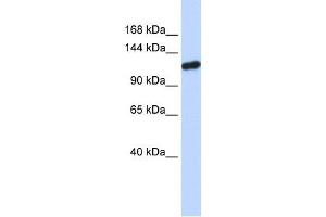 PIWIL4 antibody used at 1 ug/ml to detect target protein. (PIWIL4 anticorps)