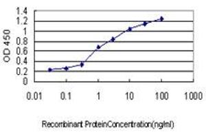 Detection limit for recombinant GST tagged CRX is approximately 0. (CRX anticorps  (AA 1-95))