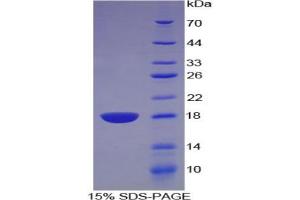SDS-PAGE analysis of Rat Artemin Protein. (ARTN Protéine)