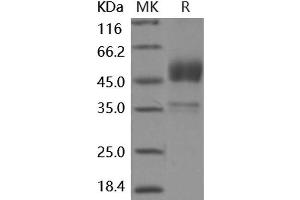 Western Blotting (WB) image for Bone Morphogenetic Protein Receptor, Type IB (BMPR1B) protein (Fc Tag) (ABIN7194418) (BMPR1B Protein (Fc Tag))