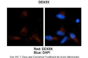Sample Type :  Human brain stem cells (NT2)   Primary Antibody Dilution :   1:500  Secondary Antibody :  Goat anti-rabbit Alexa Fluor 594  Secondary Antibody Dilution :   1:1000  Color/Signal Descriptions :  Red: DDX3X Blue: DAPI  Gene Name :  DDX3X  Submitted by :  Dr. (DDX3X anticorps  (N-Term))