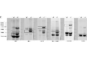 Development of multiple gene expression pigs with GT knock-out. (CD55 anticorps  (Center))