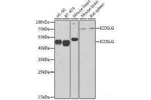 Western blot analysis of extracts of various cell lines using ICOSL Polyclonal Antibody at dilution of 1:1000. (ICOSLG anticorps)