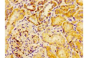 Immunohistochemistry of paraffin-embedded human kidney tissue using ABIN7150914 at dilution of 1:100 (Dysferlin anticorps  (AA 105-278))