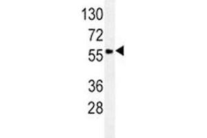 GCET1/SERPINA9 antibody western blot analysis in Ramos lysate. (SERPINA9 anticorps  (AA 158-186))