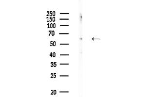Western blot analysis of lysates from COLO205 cells(heat-shock,45 min treatment), using Phospho-SQSTM1/p62 (Thr269/Ser272) Antibody at 1/1000 dilution.