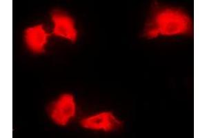 Immunofluorescent analysis of Kanadaptin staining in A431 cells. (NADAP anticorps  (Center))