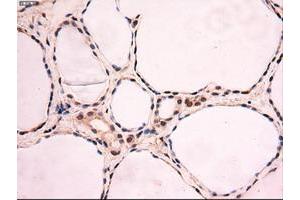 Image no. 8 for anti-Myc Proto-Oncogene protein (MYC) antibody (ABIN1497012) (c-MYC anticorps)