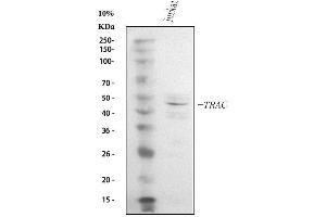 Western blot analysis of TCR alpha/TRAC using anti-TCR alpha/TRAC antibody (ABIN6719654). (TRAC anticorps  (AA 1-114))