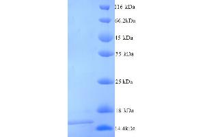 SDS-PAGE (SDS) image for Frataxin (FXN) (AA 78-207) protein (His tag) (ABIN5713460)