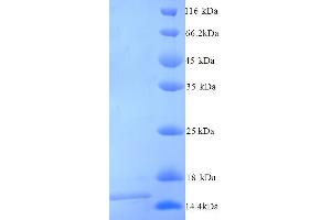 SDS-PAGE (SDS) image for Frataxin (FXN) (AA 78-207) protein (His tag) (ABIN5713460) (Frataxin Protein (FXN) (AA 78-207) (His tag))