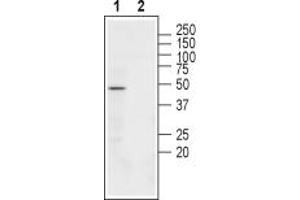 anti-Cholinergic Receptor, Nicotinic, beta 3 (Neuronal) (CHRNB3) (AA 211-222), (Extracellular) antibody