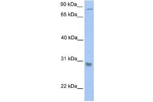 GSTT1 antibody used at 1 ug/ml to detect target protein. (GSTT1 anticorps  (C-Term))