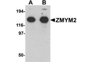 Western blot analysis of ZMYM2 in EL4 cell lysate with ZMYM2 antibody at (A) 0. (ZMYM2 anticorps  (N-Term))