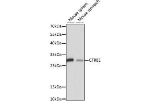 Western blot analysis of extracts of various cell lines, using CTRB1 antibody (ABIN7266398) at 1:1000 dilution. (CTRB1 anticorps  (AA 79-263))