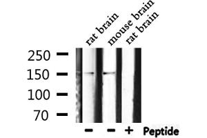 Western blot analysis of extracts from rat brain, mouse brain, using Phospho-PLCG1 (Tyr771) Antibody. (Phospholipase C gamma 1 anticorps  (pTyr771))