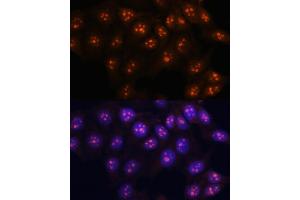 Immunofluorescence analysis of HeLa cells using Fibrillarin/U3 RNP antibody (ABIN6130429, ABIN6140494, ABIN6140496 and ABIN6217509) at dilution of 1:100. (Fibrillarin anticorps  (AA 100-321))