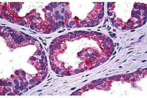 Human Prostate: Formalin-Fixed, Paraffin-Embedded (FFPE) (MAPK13 anticorps  (AA 251-365))