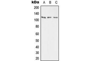 Western blot analysis of PMCA2 expression in HEK293T (A), mouse brain (B), rat brain (C) whole cell lysates. (ATP2B2 anticorps  (Center))