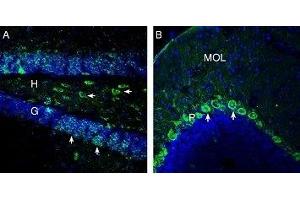 Expression of OXGR1/GPR99 in mouse hippocampus and cerebellum - Immunohistochemical staining of perfusion-fixed frozen mouse brain sections with Anti-OXGR1/GPR99 Antibody (ABIN7043418, ABIN7044895 and ABIN7044896), (1: 200), followed by goat anti-rabbit-AlexaFluor-488. (OXGR1 anticorps  (Intracellular))