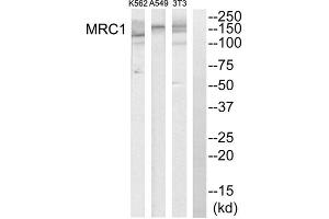 Western blot analysis of extracts from K562 cells, A549 cells and NIH-3T3 cells, using MRC1 antibody. (Macrophage Mannose Receptor 1 anticorps  (Internal Region))