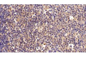Detection of FKBP7 in Porcine Lymph node Tissue using Polyclonal Antibody to FK506 Binding Protein 7 (FKBP7)