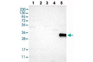 Western blot analysis of Lane 1: RT-4 cells, Lane 2: U-251MG sp cells, Lane 3: Human plasma (IgG/HSA depleted), Lane 4: Human liver tissue, Lane 5: Human tonsil tissue with CD226 polyclonal antibody . (CD226 anticorps  (AA 102-251))