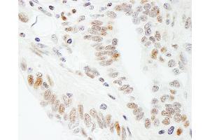 anti-Transcription Elongation Factor SPT5 (SUPT5H) (C-Term) antibody