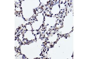 Immunohistochemistry of paraffin-embedded rat lung using R Rabbit mAb (ABIN7269844) at dilution of 1:100 (40x lens).