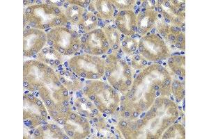 Immunohistochemistry of paraffin-embedded Mouse kidney using NLRC4 Polyclonal Antibody at dilution of 1:100 (40x lens). (NLRC4 anticorps)