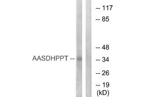 Western blot analysis of extracts from COLO cells, using AASDHPPT antibody. (AASDHPPT anticorps  (N-Term))