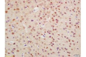 Formalin-fixed and paraffin embedded mouse brain labeled with Anti-OTX1 + OTX2 Polyclonal Antibody, Unconjugated (ABIN1387702) at 1:200 followed by conjugation to the secondary antibody and DAB staining (Otx1 + Otx2 (AA 21-120) anticorps)