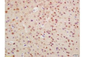 Formalin-fixed and paraffin embedded mouse brain labeled with Anti-OTX1 + OTX2 Polyclonal Antibody, Unconjugated (ABIN1387702) at 1:200 followed by conjugation to the secondary antibody and DAB staining (Otx1 + Otx2 (AA 21-120) anticorps)