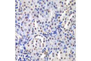 Immunohistochemistry of paraffin-embedded mouse kidney using PRKCB antibody at dilution of 1:200 (400x lens). (PKC beta anticorps)