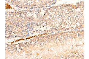 ABIN6267070 at 1/100 staining mouse testis tissue sections by IHC-P. (NF-kB p65 anticorps  (pSer536))
