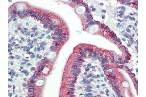 Human Small Intestine (formalin-fixed, paraffin-embedded) stained with LASS5at 5 µg/ml followed by biotinylated goat anti-rabbit IgG secondary antibody, alkaline phosphatase-streptavidin and chromogen. (LASS5 anticorps  (C-Term))